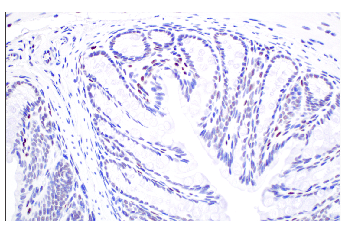 Immunohistochemistry Image 4: TCF4/ITF2 (E3X2Y) Rabbit Monoclonal Antibody
