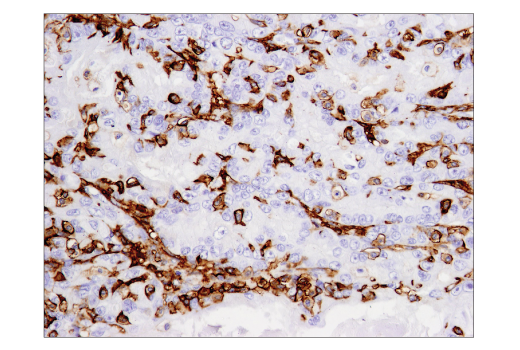 Immunohistochemistry Image 3: CD14 (D7A2T) Rabbit Monoclonal Antibody (BSA and Azide Free)