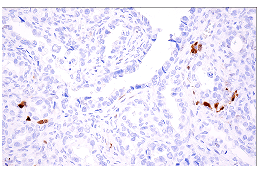 Immunohistochemistry Image 7: Calretinin (E7R6O) XP<sup>®</sup> Rabbit mAb (BSA and Azide Free)