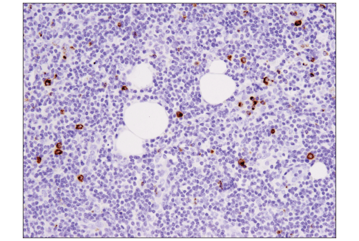 undefined Image 70: Human Exhausted CD8<sup>+</sup> T Cell IHC Antibody Sampler Kit