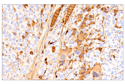 Immunohistochemistry Image 7: Parvalbumin (E8N2U) Rabbit Monoclonal Antibody