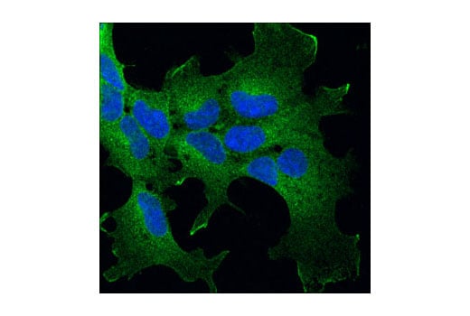 Immunofluorescence Image 1: p115 RhoGEF (D25D2) XP<sup>®</sup> Rabbit mAb
