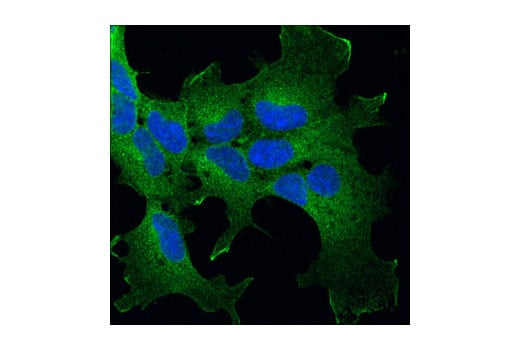 Immunofluorescence Image 1: p115 RhoGEF (D25D2) Rabbit Monoclonal Antibody