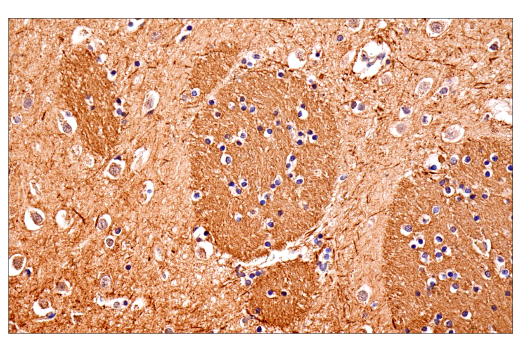 Immunohistochemistry Image 1: Neurofilament-M (E7L2T) Rabbit Monoclonal Antibody