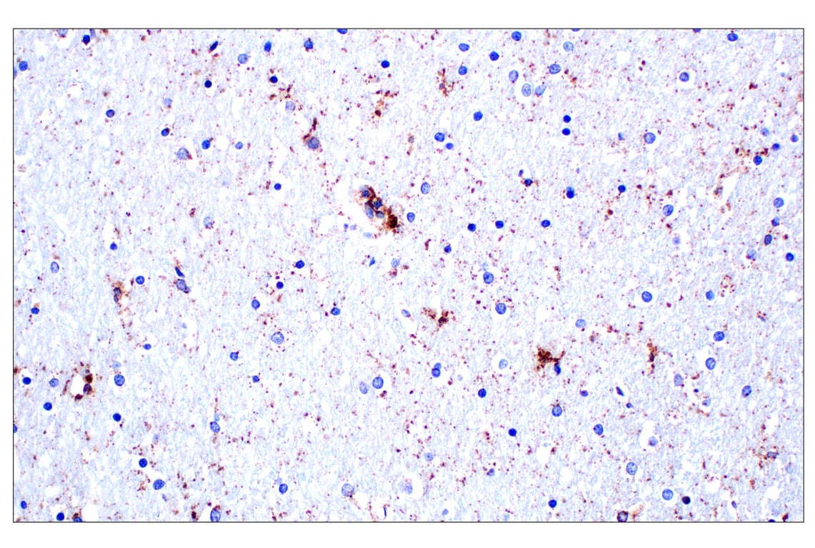 undefined Image 36: Genetics of Parkinson's Disease: Lysosomal Dysfunction Antibody Sampler Kit