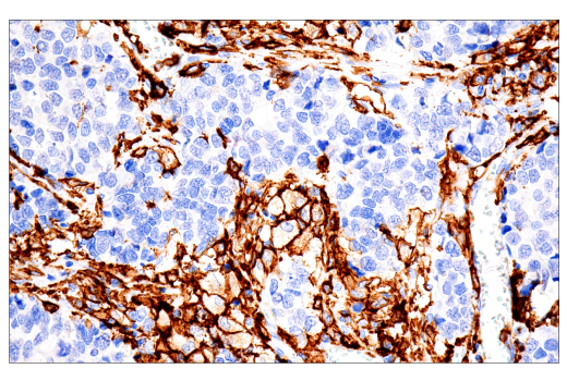 Immunohistochemistry Image 1: FcR gamma (E6Y1A) Rabbit Monoclonal Antibody