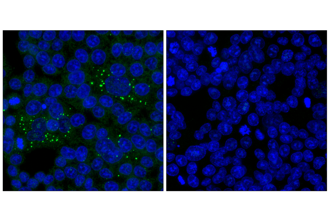 Immunofluorescence Image 1: WIPI2 (2A2) Mouse Monoclonal Antibody