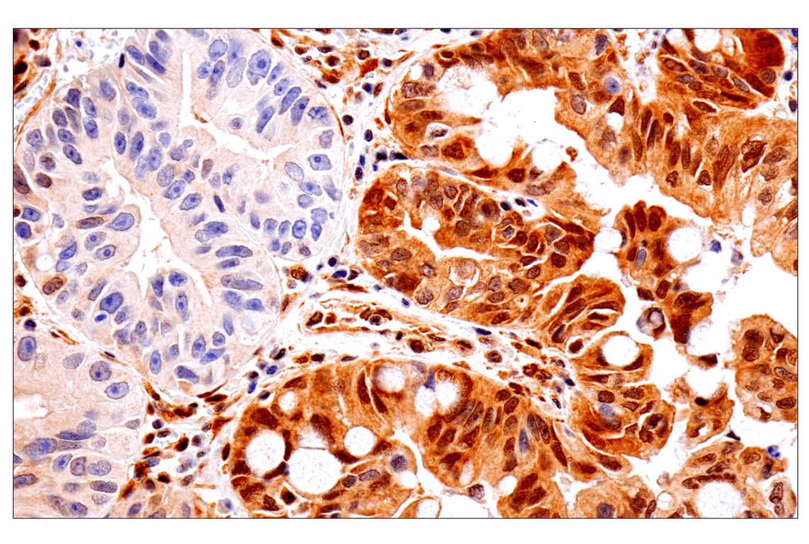 Immunohistochemistry Image 2: PTEN (138G6) Rabbit Monoclonal Antibody (BSA and Azide Free)