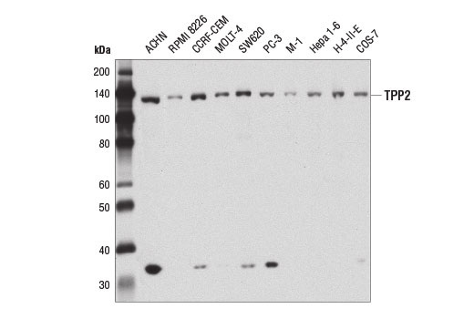 Western Blotting Image 2: TPP2 Antibody