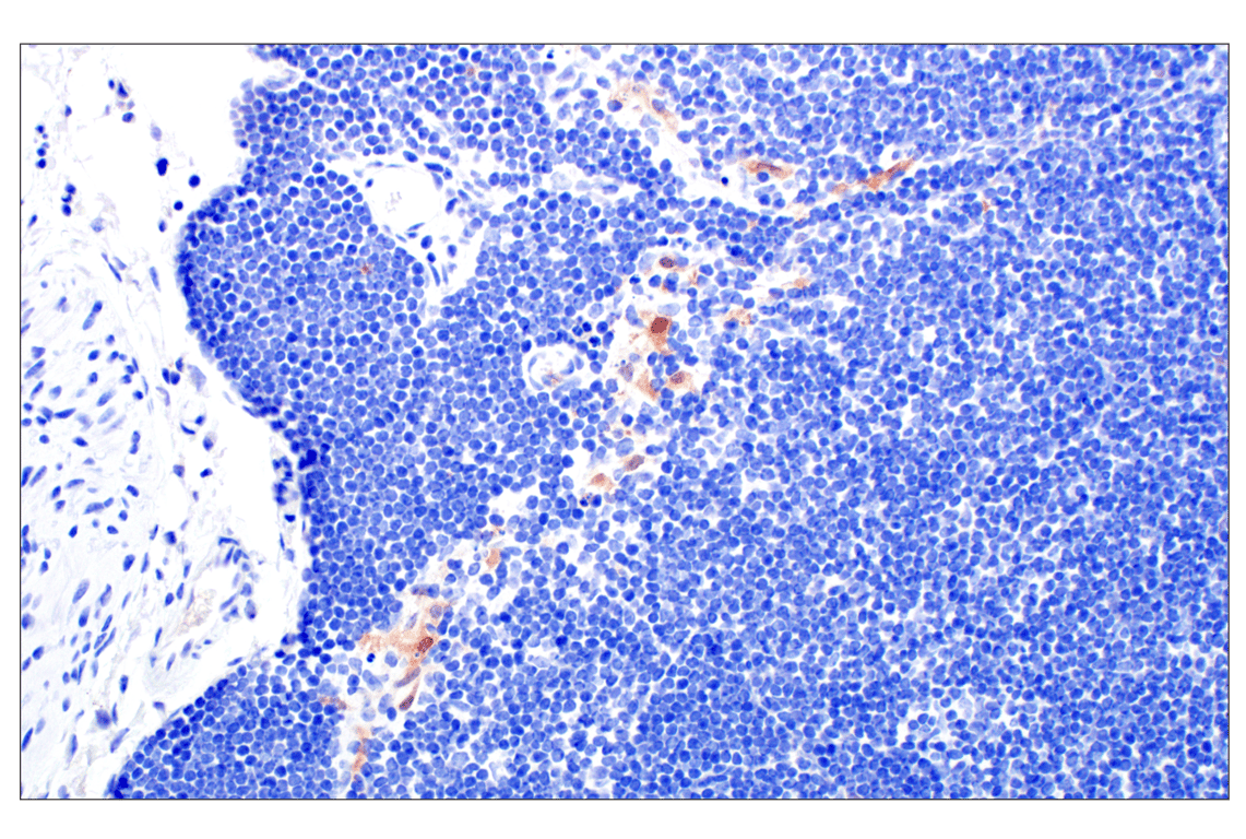 Immunohistochemistry Image 5: p16 INK4A (F2T7H) Rabbit Monoclonal Antibody