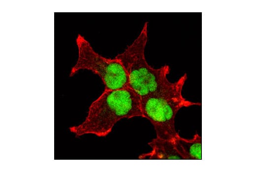 Immunofluorescence Image 1: JMJD2A (C70G6) Rabbit Monoclonal Antibody