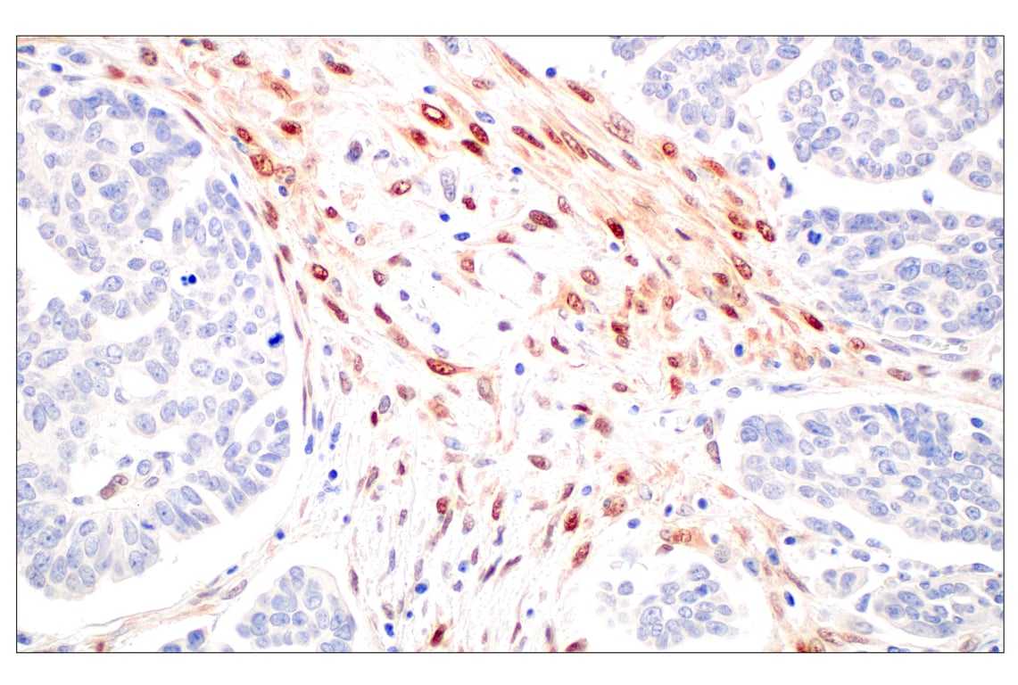 Immunohistochemistry Image 1: ARK5 (E4T2A) Rabbit Monoclonal Antibody