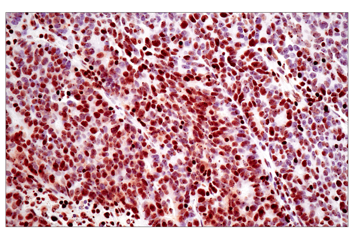 Immunohistochemistry Image 2: Tri-Methyl-Histone H3 (Lys27) (C36B11) Rabbit Monoclonal Antibody (BSA and Azide Free)