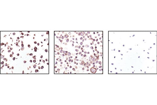 Immunohistochemistry Image 3: HER2/ErbB2 (29D8) Rabbit Monoclonal Antibody