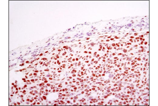 Immunohistochemistry Image 1: MTA1 (D40D1) Rabbit Monoclonal Antibody