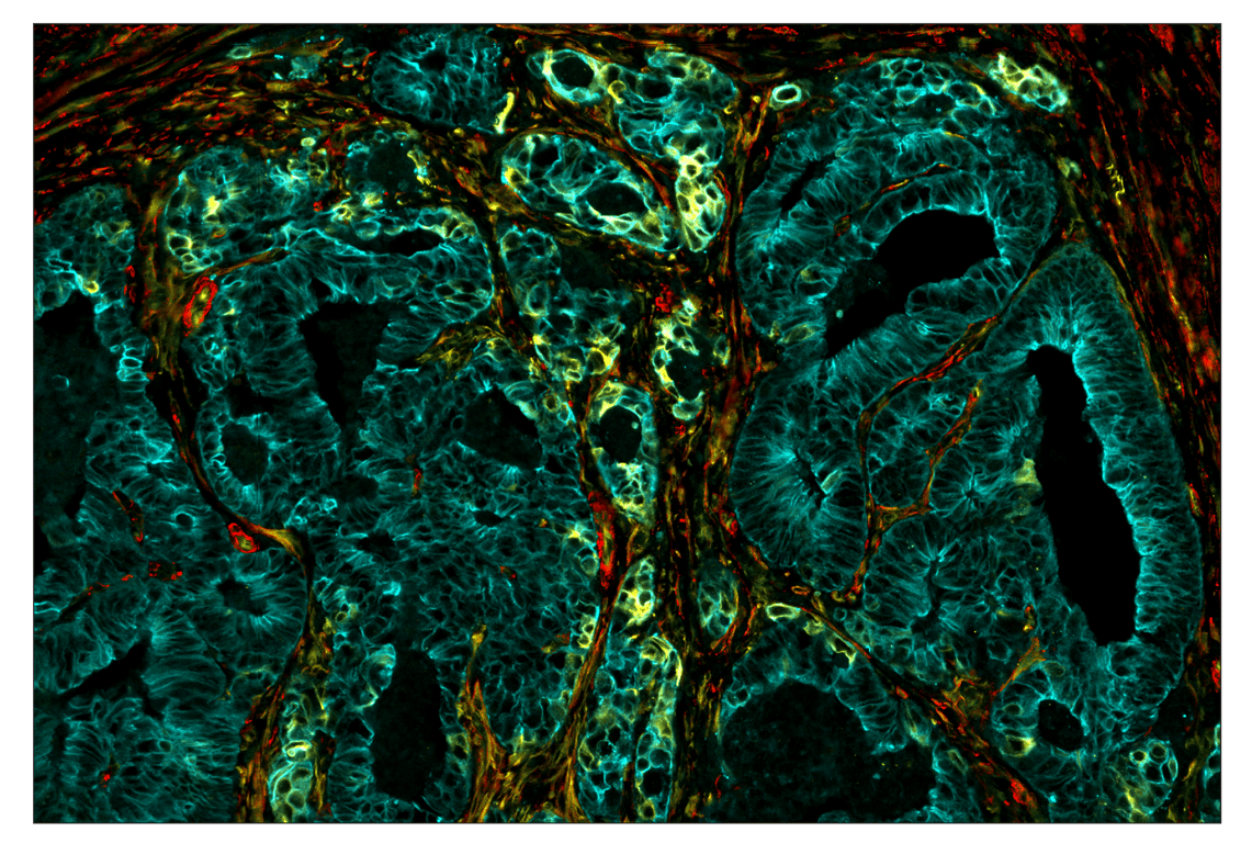 Immunohistochemistry Image 1: beta3-Tubulin (E9F3E) & CO-0128-750 SignalStar<sup>™</sup> Oligo-Antibody Pair