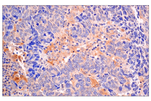 Immunohistochemistry Image 2: VHL (E3X9K) Rabbit Monoclonal Antibody
