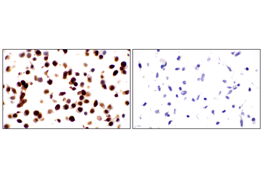 Immunohistochemistry Image 8: p53 (DO-1) Mouse Monoclonal Antibody
