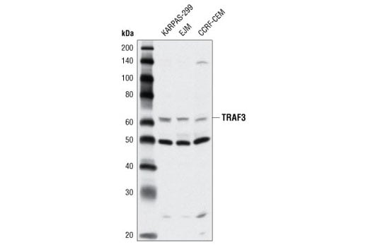 undefined Image 14: NF-kappaB Non-Canonical Pathway Antibody Sampler Kit