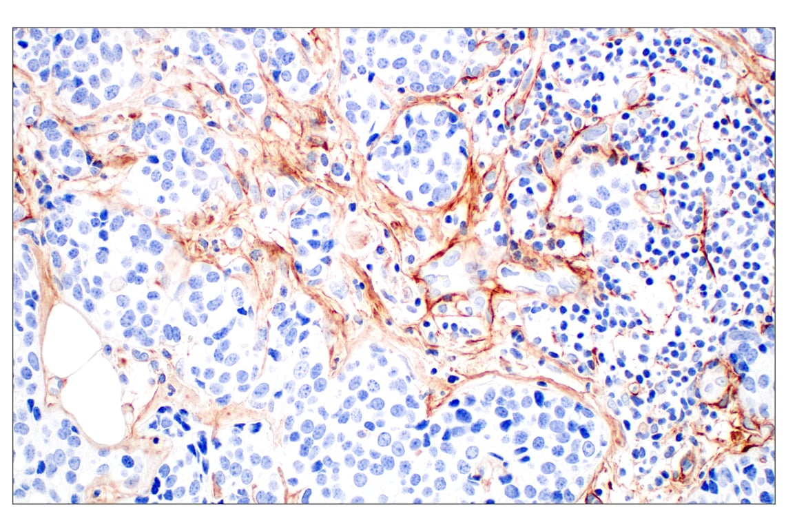 Immunohistochemistry Image 5: Tenascin C (E6N4L) Rabbit mAb