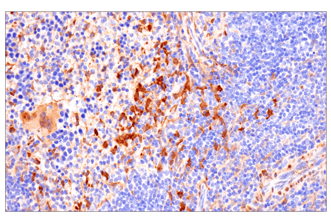 Immunohistochemistry Image 18: PPP1R14A/CPI-17 (F1I6X) Rabbit Monoclonal Antibody