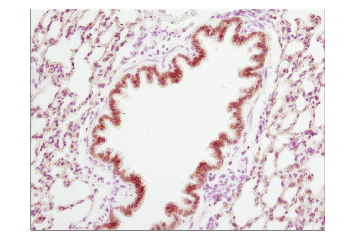Immunohistochemistry Image 6: E-Cadherin (24E10) Rabbit Monoclonal Antibody (BSA and Azide Free)