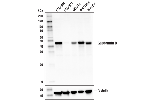 undefined Image 19: Gasdermin Family Antibody Sampler Kit