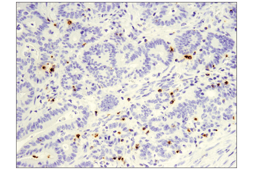 undefined Image 22: Human Exhausted CD8<sup>+</sup> T Cell IHC Antibody Sampler Kit