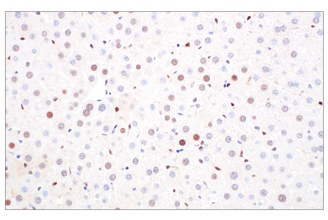 Immunohistochemistry Image 2: CDK4 (F8L5F) Rabbit Monoclonal Antibody