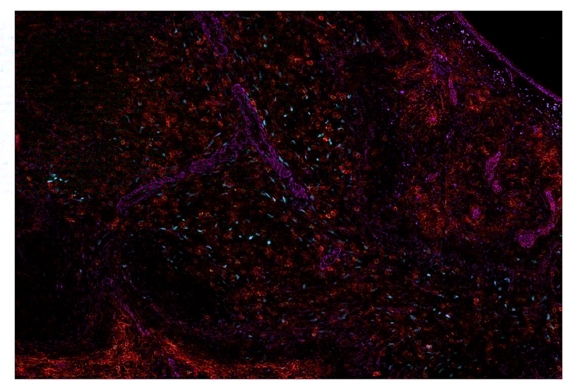 Immunohistochemistry Image 2: NT5E/CD73 (D7F9A) & CO-0039-594 SignalStar<sup>™</sup> Oligo-Antibody Pair