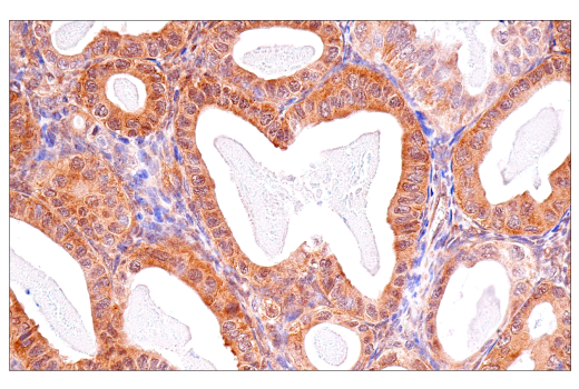Immunohistochemistry Image 2: p70 S6 Kinase (E8K6T) Rabbit Monoclonal Antibody (BSA and Azide Free)