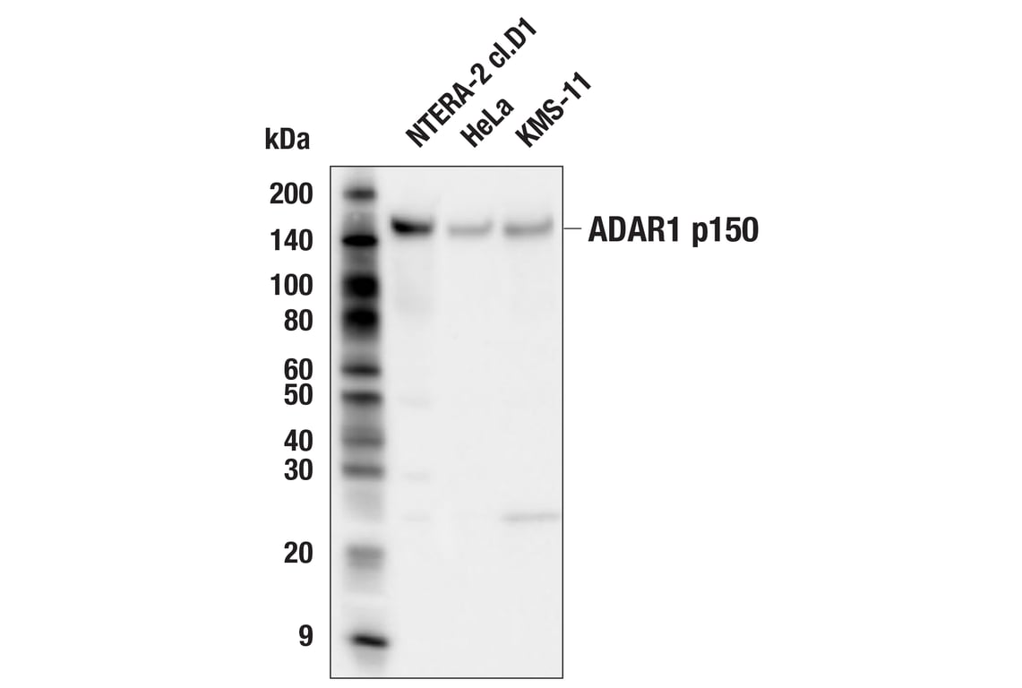 Western Blotting Image 3: ADAR1 p150 Isoform (E6U1U) Rabbit Monoclonal Antibody