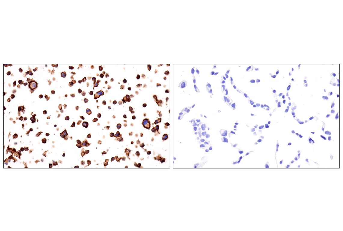 Immunohistochemistry Image 11: HLA-B (BC43) Mouse Monoclonal Antibody