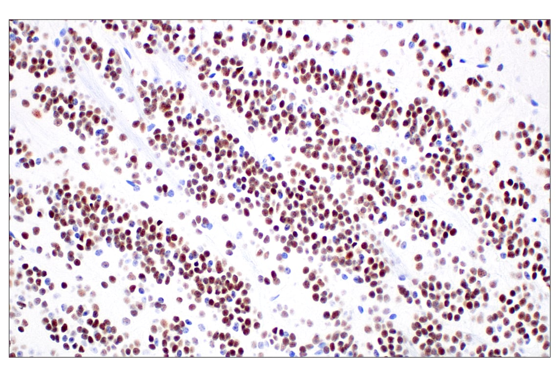 Immunohistochemistry Image 2: FOXG1 (E2W8P) Rabbit Monoclonal Antibody