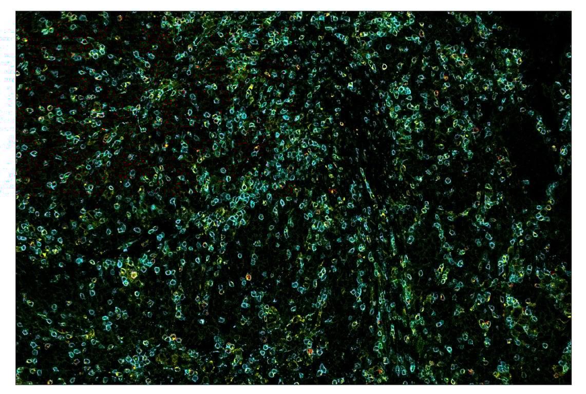 Immunohistochemistry Image 7: CD3 epsilon (D7A6E<sup>™</sup>) & CO-0001-750 SignalStar<sup>™</sup> Oligo-Antibody Pair