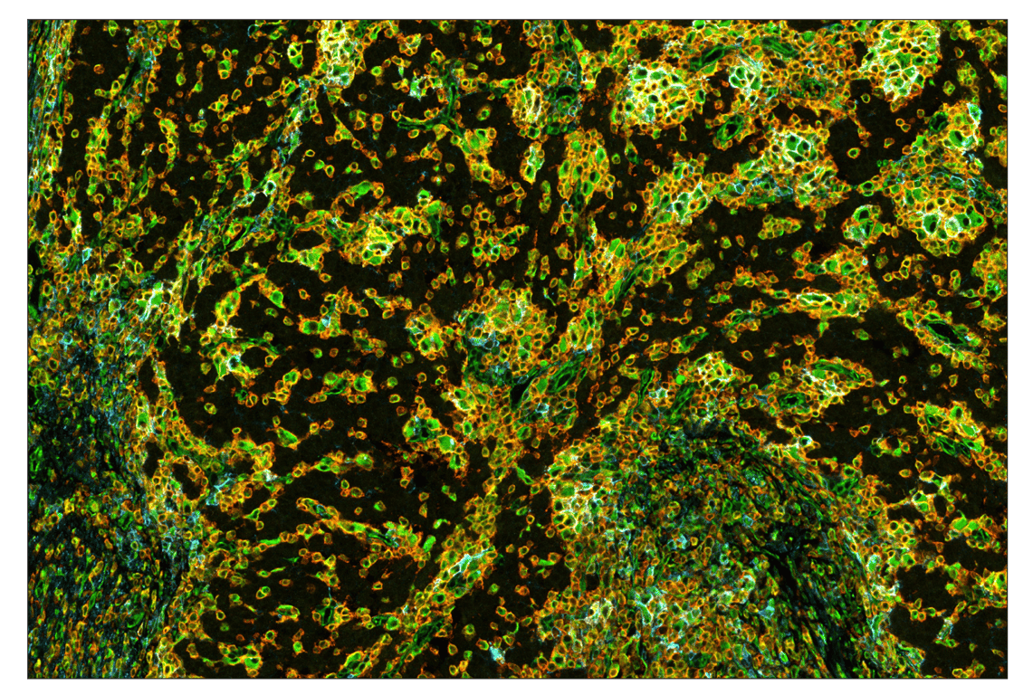 Immunohistochemistry Image 2: SignalStar<sup>™</sup> Miniplex IHC Buffer Kit
