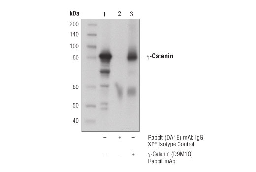 Immunoprecipitation Image 1: gamma-Catenin (D9M1Q) Rabbit Monoclonal Antibody