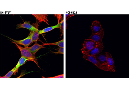 Immunofluorescence Image 1: CRMP-2 (D8L6V) Rabbit Monoclonal Antibody