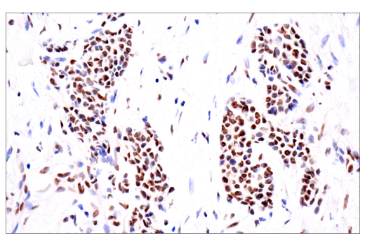 Immunohistochemistry Image 1: TDP43 (E2G6G) Rabbit Monoclonal Antibody