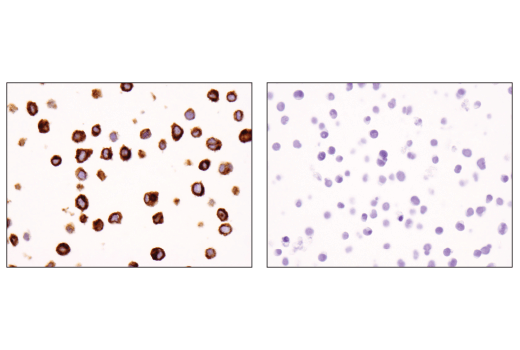 undefined Image 56: Human Exhausted CD8<sup>+</sup> T Cell IHC Antibody Sampler Kit
