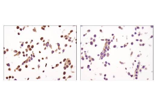 Immunohistochemistry Image 2: XIAP (D2Z8W) Rabbit Monoclonal Antibody