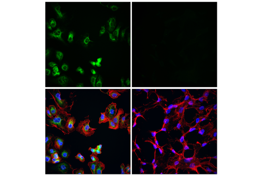 Immunofluorescence Image 1: p22phox (E7Y1F) Rabbit Monoclonal Antibody (BSA and Azide Free)