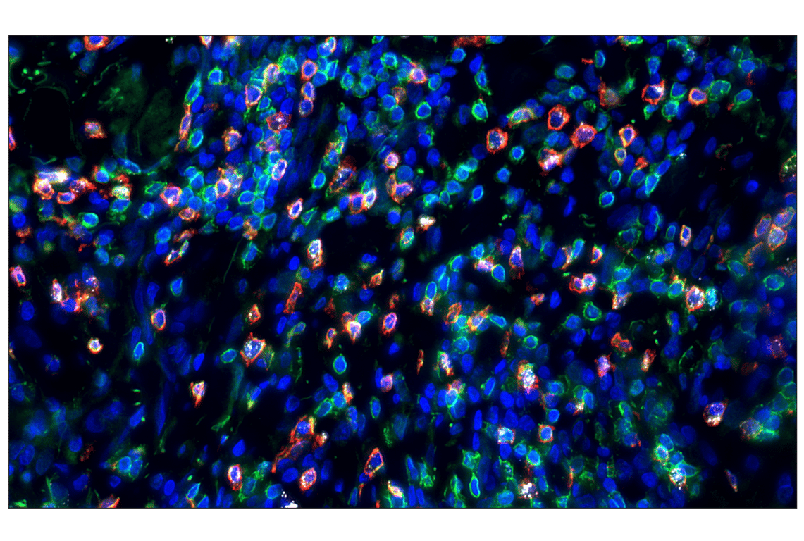 Immunohistochemistry Image 2: CD8 alpha (D8A8Y) Rabbit Monoclonal Antibody (Alexa Fluor<sup>®</sup> 555 Conjugate)