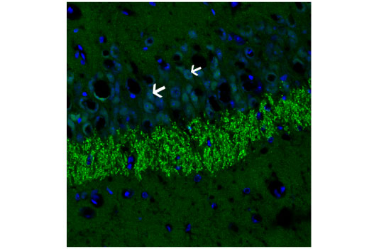 Immunofluorescence Image 2: Phospho-alpha-Synuclein (Ser129) (D1R1R) Rabbit Monoclonal Antibody (BSA and Azide Free)