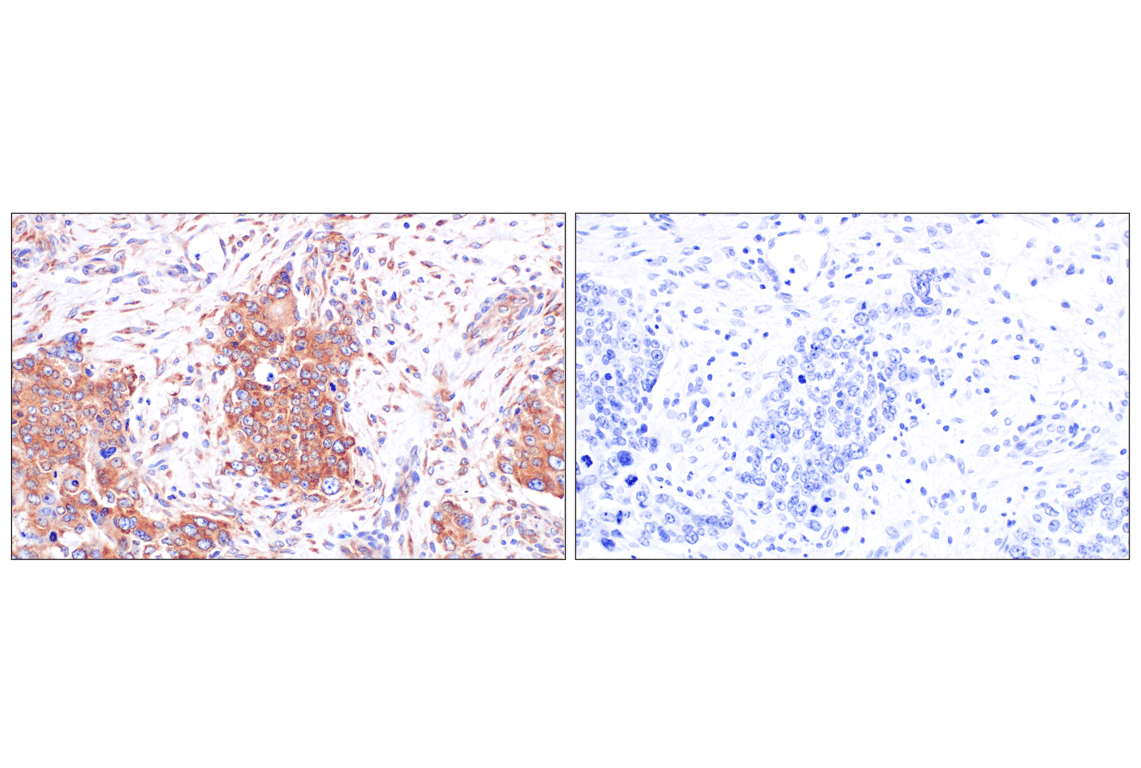 Immunohistochemistry Image 9: PABP1 (F6G6L) Rabbit Monoclonal Antibody