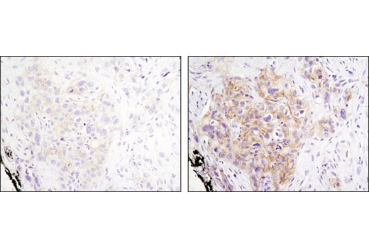 Immunohistochemistry Image 2: Phospho-HER3/ErbB3 (Tyr1289) (D1B5) Rabbit Monoclonal Antibody (BSA and Azide Free)