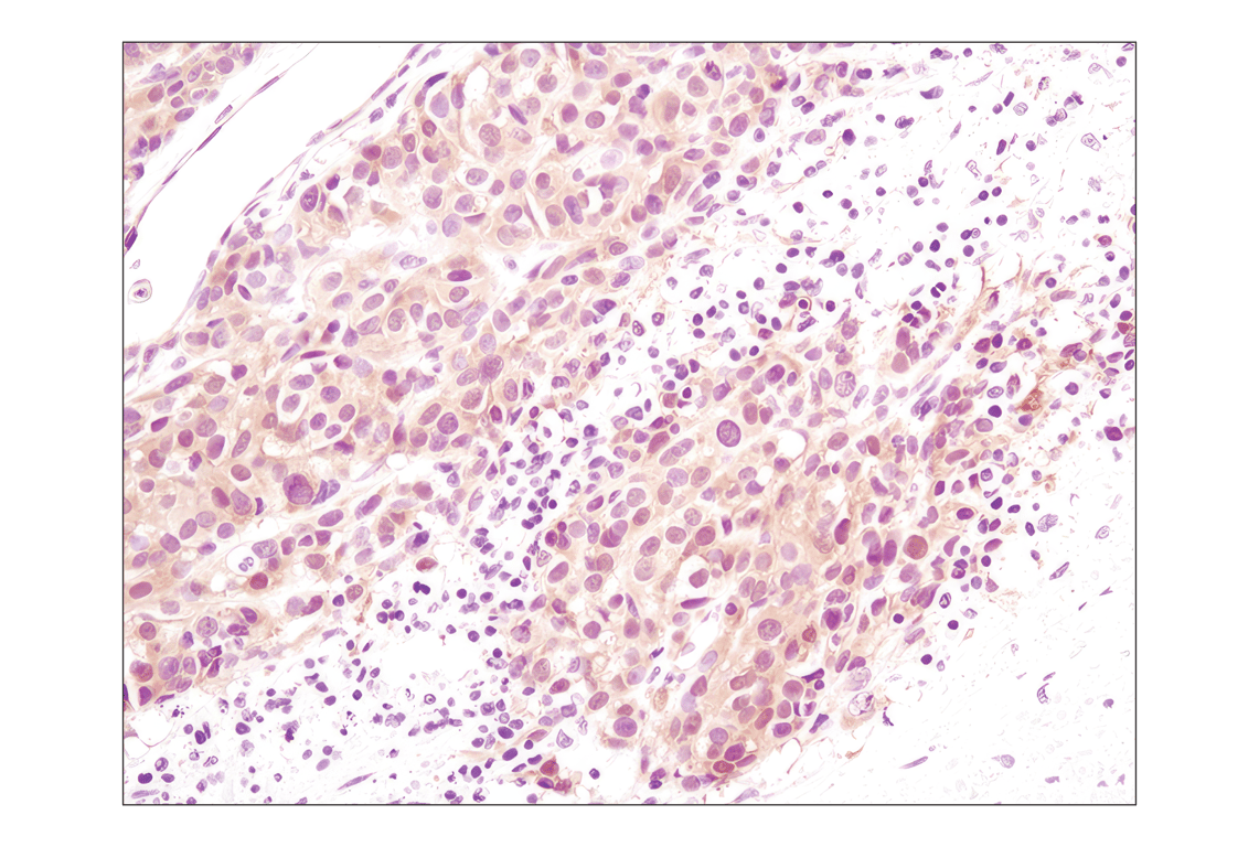 Immunohistochemistry Image 1: Akt (pan) (C67E7) Rabbit Monoclonal Antibody