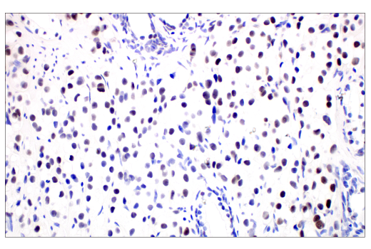 Immunohistochemistry Image 2: SignalStain<sup>®</sup> Deep Black Peroxidase Substrate Kit