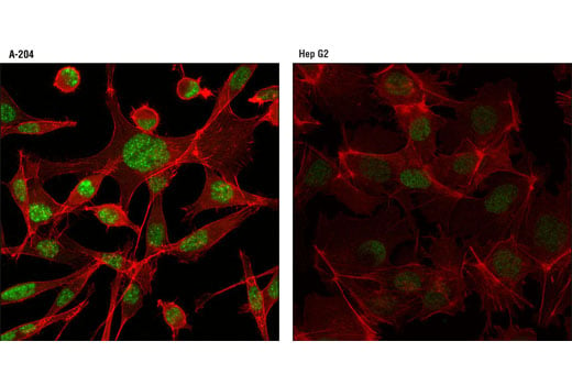 Immunofluorescence Image 1: PIAS3 (D5F9) XP<sup>®</sup> Rabbit mAb
