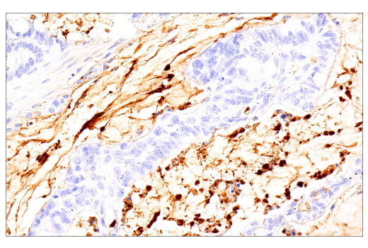 Immunohistochemistry Image 4: IgM (E9U8J) XP<sup>®</sup> Rabbit mAb